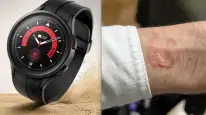 Samsung Galaxy Watch 5 Pro Aşırı Isınma Sorunuyla Gündemde!