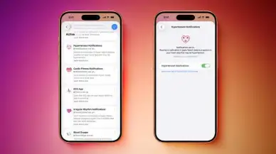 Apple Watch'un Yüksek Tansiyon Bildirimleri Bugünden İtibaren Kanada ve Singapur'da Kullanıma Sunulacak
